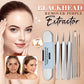 Stainless Steel Blackhead Remover Tool Kit